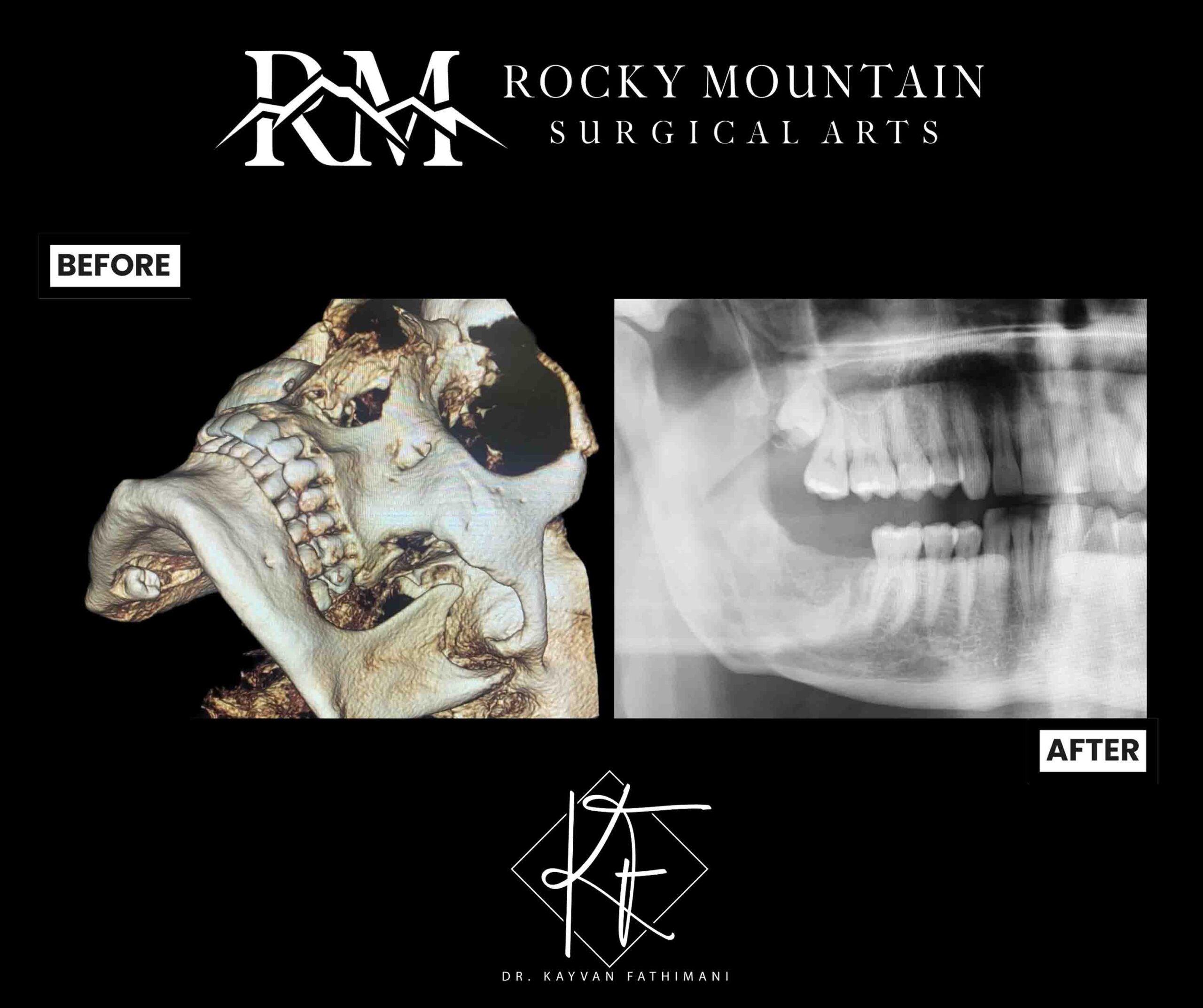 facial-jaw-pathology-subpage-ba-1-b