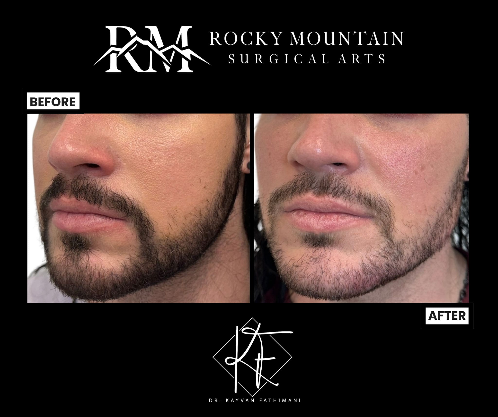 final-4_4-S3E-1-2048x1717