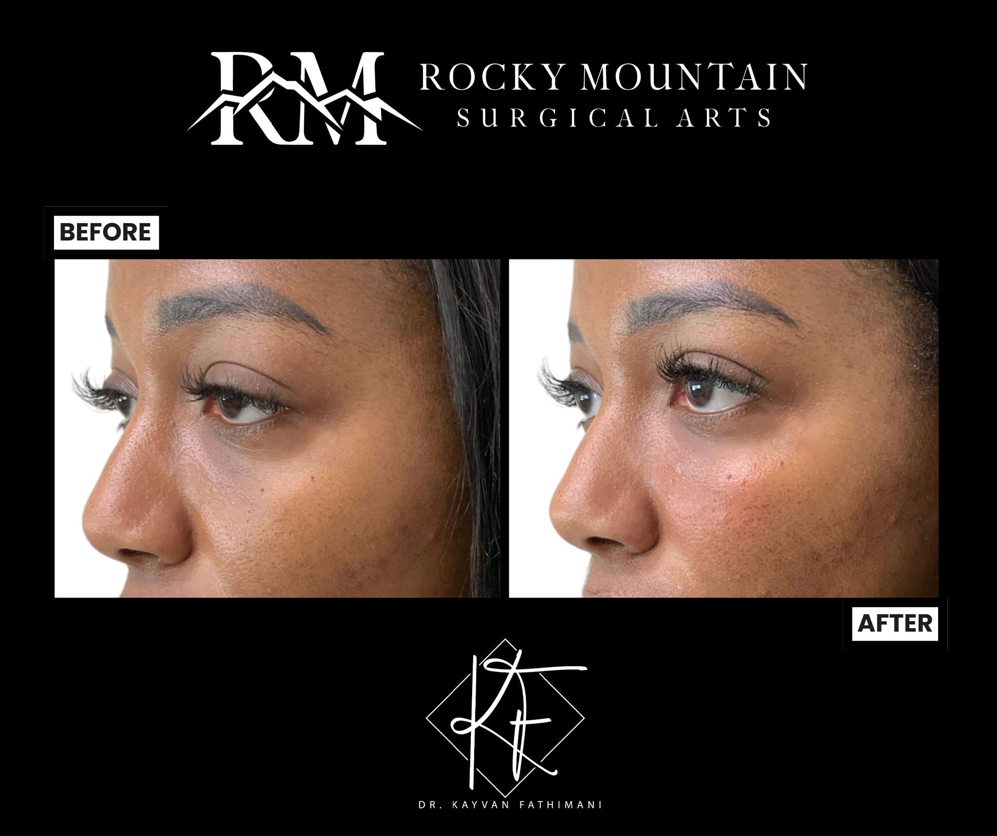 final-fillers-S3E-4-2048x1717-1