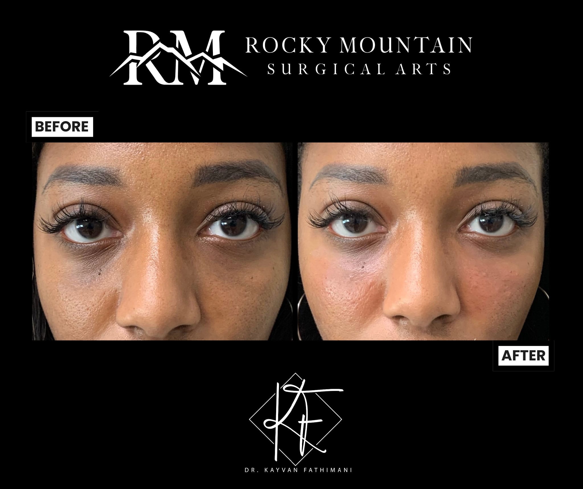 final-fillers-S3E-5-2048x1717