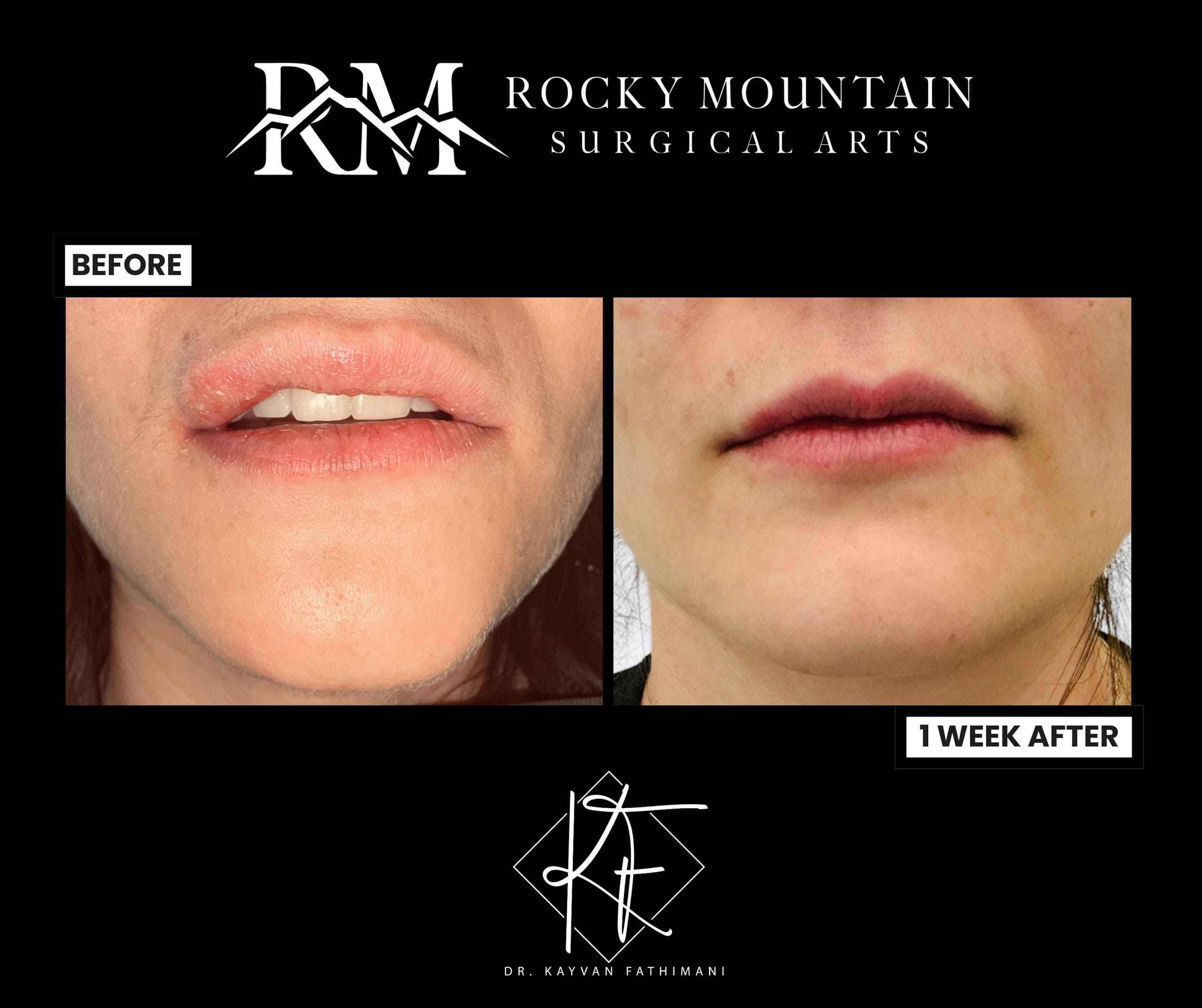 facial-jaw-pathology-2-scaled