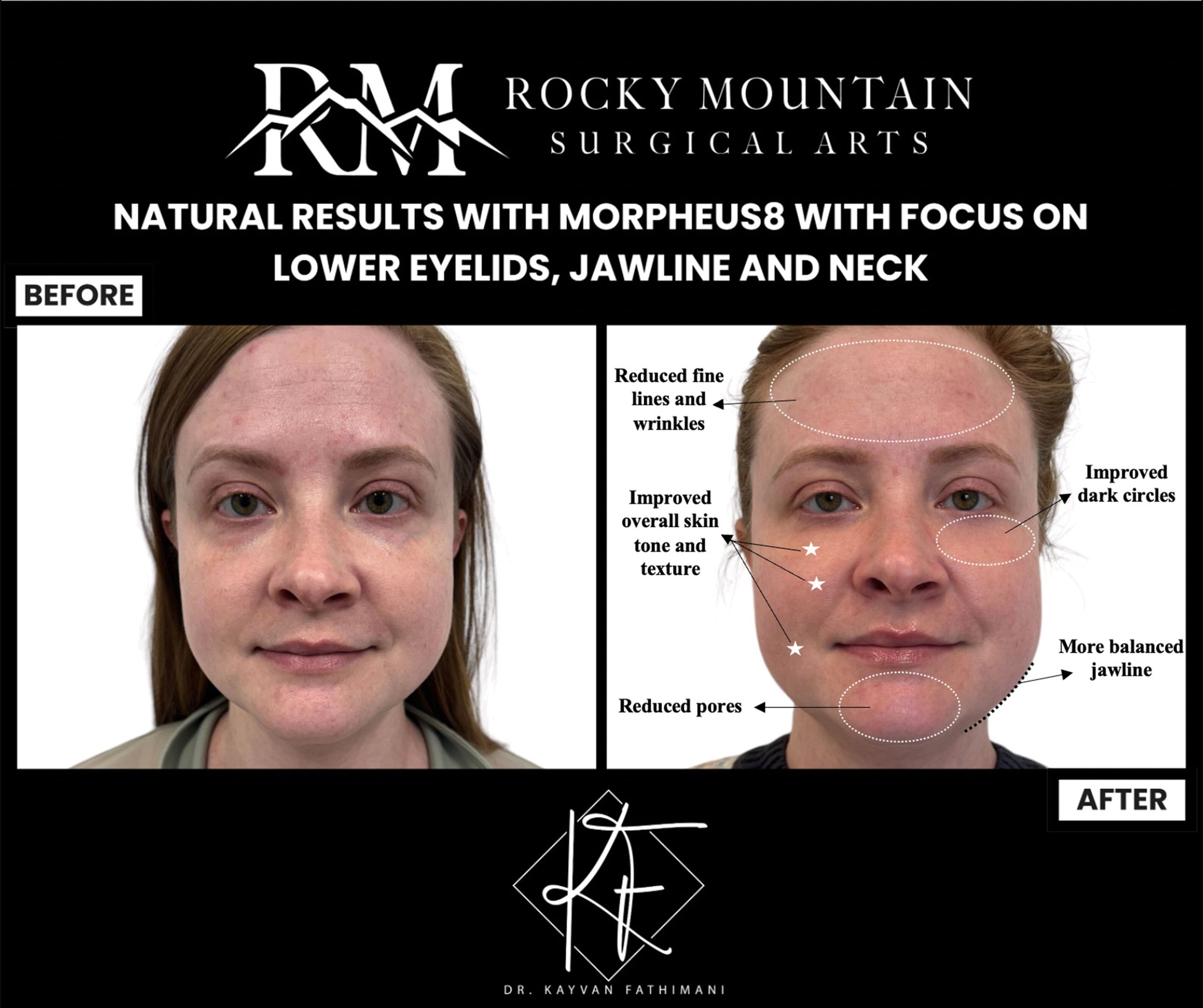 Non-Surgical-Skin-Rejuvenation-1-1