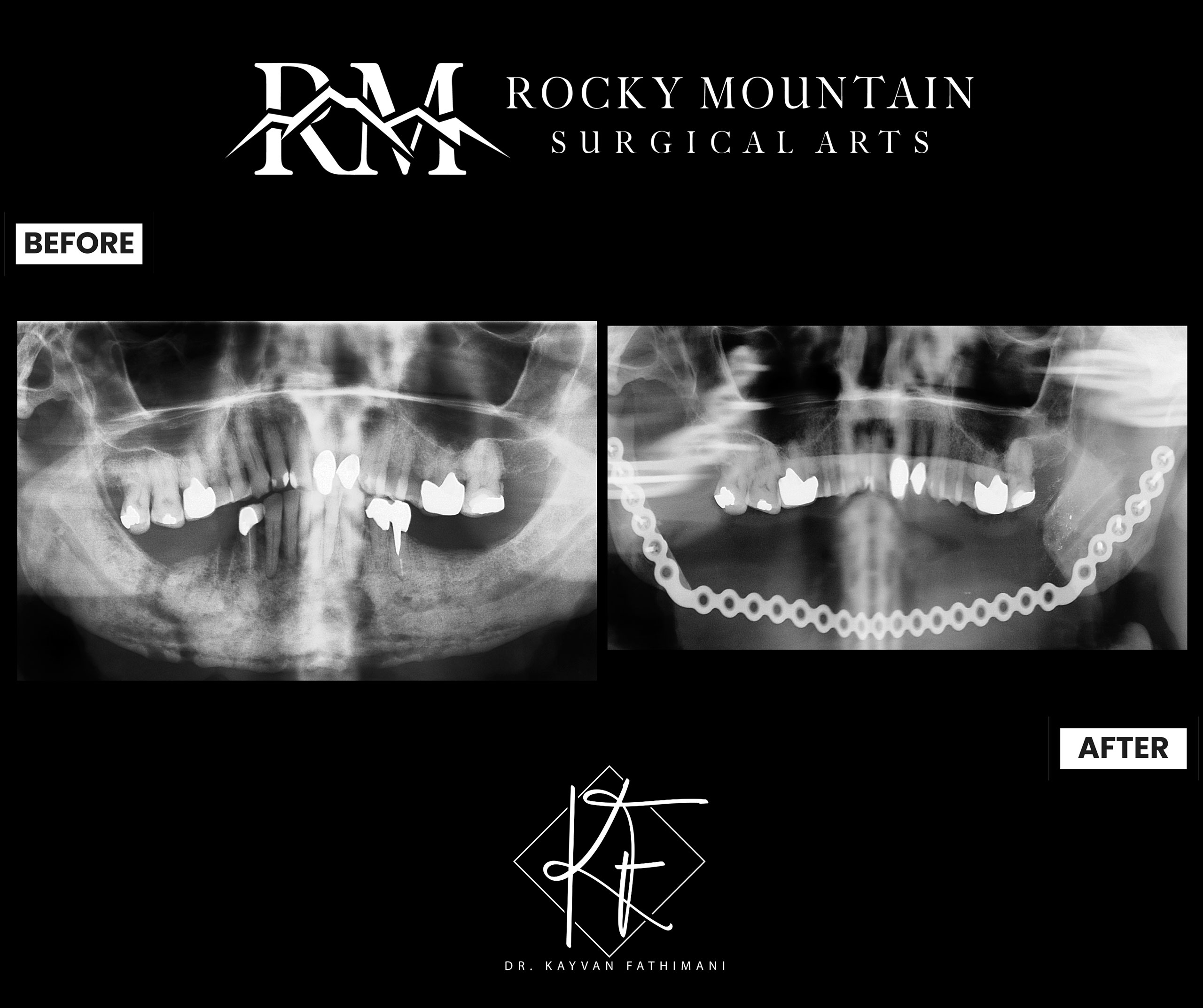Facial-and-Jaw-Pathology-7-1