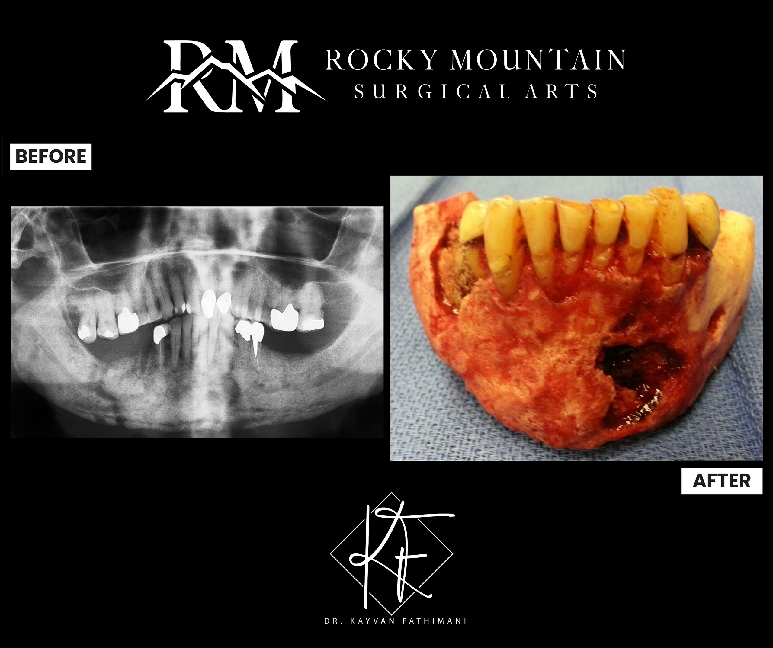 Facial-and-Jaw-Pathology-7-3