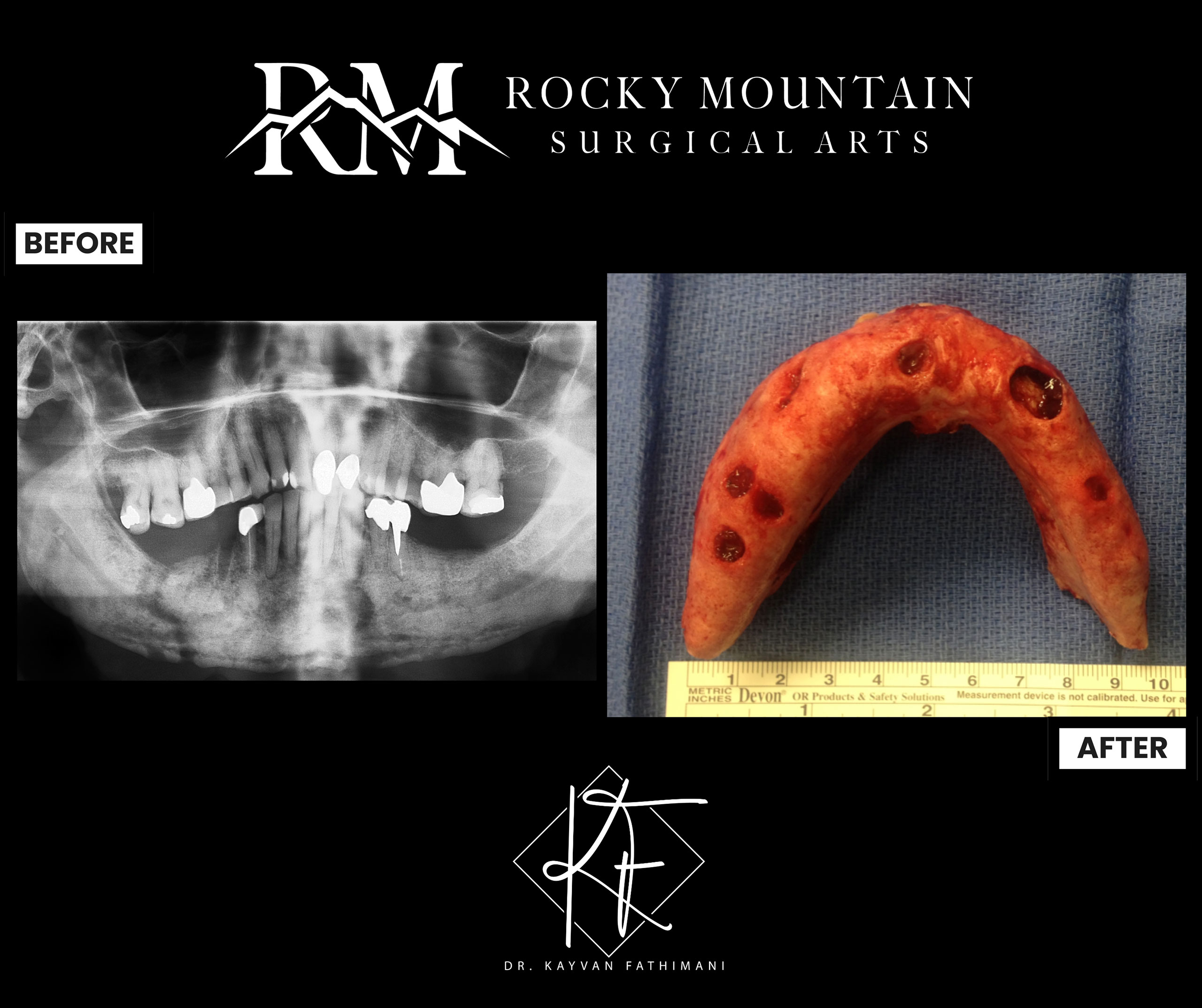 Facial-and-Jaw-Pathology-7-4